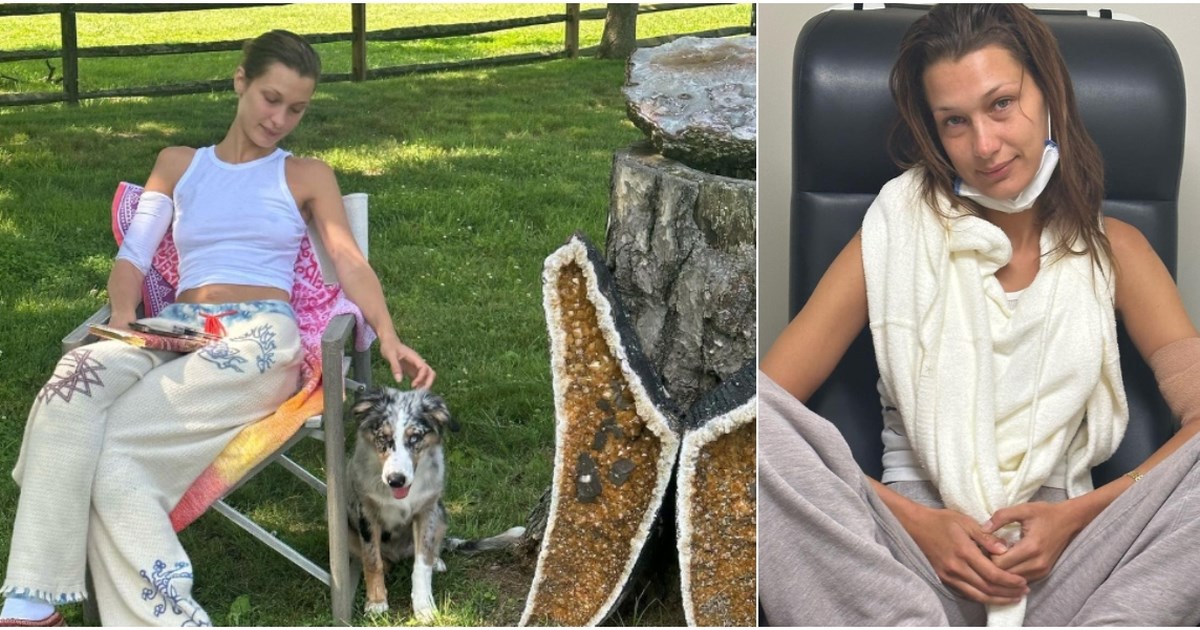 Καταβεβλημένη η Μπέλα Χαντίντ, μοιράστηκε φωτογραφίες από τις θεραπείες της - Η μάχη που δίνει με τη νόσο Lyme