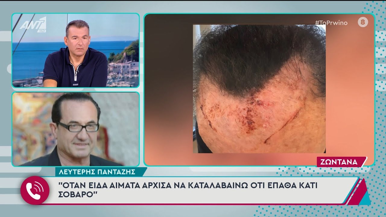Λευτέρης Πανταζής: «Είχα κακό μάτι, φαίνεται και χτύπησα»